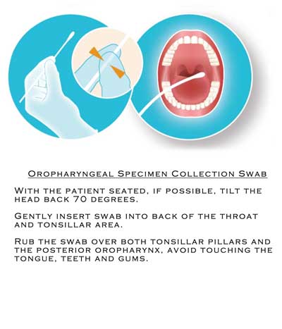 Oropharyngeal specimen collection using sterile flocked swabs