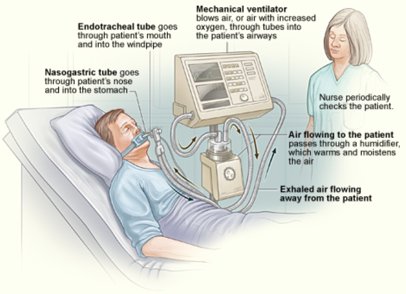 Description on how medical gas hose is used in a ventilator